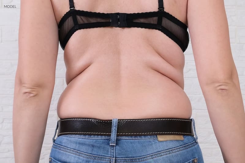 Find the Right Bra and Help Minimize Back Fat