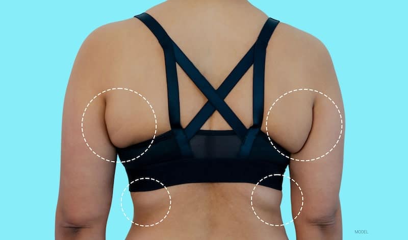 Ladies, If you want to get rid of Bra Fat & Back Rolls, try these 3 Ex, Back Workouts